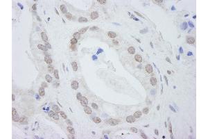 Immunohistochemistry (IHC) image for anti-DEAD (Asp-Glu-Ala-Asp) Box Polypeptide 24 (DDX24) (C-Term) antibody (ABIN7448518) (DDX24 antibody  (C-Term))