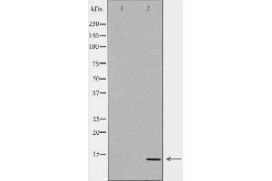 Western blot analysis of JAR  lysate using CGA antibody. (CGA antibody  (Internal Region))