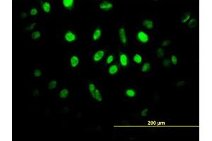 Immunofluorescence of monoclonal antibody to HIF1AN on HeLa cell. (HIF1AN antibody  (AA 1-349))