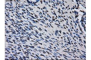 Immunohistochemical staining of paraffin-embedded colon tissue using anti-RPA2 mouse monoclonal antibody. (RPA2 antibody)