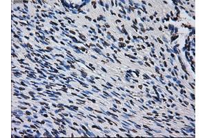 Immunohistochemical staining of paraffin-embedded colon tissue using anti-RPA2 mouse monoclonal antibody.