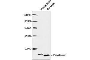 Western blot analysis of tissue lysates using 1 µg/mL Rabbit Anti-Parvalbumin Polyclonal Antibody (ABIN398923) The signal was developed with IRDye-800 Conjugated Goat Anti-Rabbit IgG. (PVALB antibody)