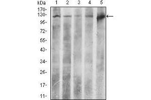 Western Blotting (WB) image for anti-ATP Citrate Lyase (ACLY) (AA 306-502) antibody (ABIN1098143)