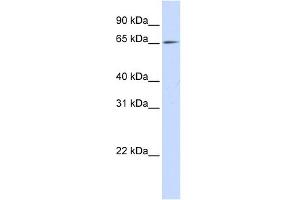 WB Suggested Anti-NET1 Antibody Titration: 0. (NET1 antibody  (N-Term))