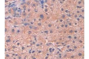 Immunohistochemistry (IHC) image for anti-Amyloid P Component, Serum (APCS) (AA 23-223) antibody (ABIN7438559)