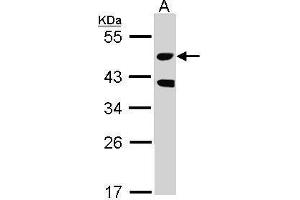 WB Image Sample (30 ug of whole cell lysate) A: Raji 10% SDS PAGE antibody diluted at 1:1000 (STK24 antibody)