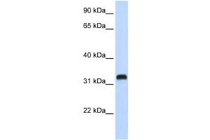 Western Blotting (WB) image for anti-Chromosome 21 Open Reading Frame 62 (C21orf62) antibody (ABIN2458967) (C21orf62 antibody)