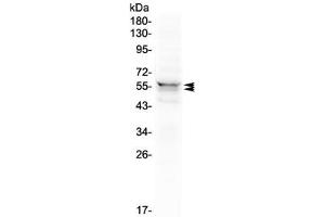 Western blot testing of human 293T cell lysate with LYN antibody at 0. (LYN antibody  (AA 470-501))