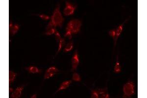 ABIN6277289 staining Hela by IF/ICC. (CD19 antibody  (C-Term))