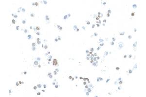 Immunocytochemistry (ICC) image for anti-Estrogen Receptor 1 (ESR1) antibody (ABIN7455134) (Estrogen Receptor alpha antibody)