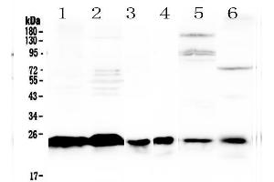 Western blot analysis of MED18 using anti-MED18 antibody .