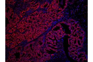 Immunofluorescence (IF) image for anti-SET Nuclear Oncogene (SET) (AA 125-175) antibody (ABIN7448788)