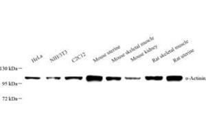 Western blot analysis of ACTN1 (ABIN7072905),at dilution of 1: 800 (ACTN1 antibody)