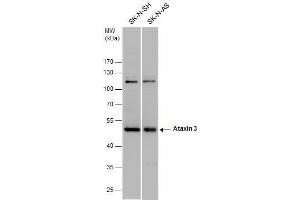 WB Image Ataxin 3 antibody detects Ataxin 3 protein by western blot analysis. (Ataxin 3 antibody)