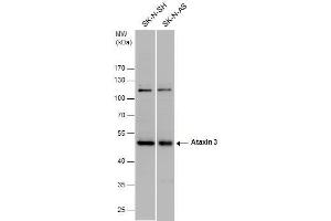 WB Image Ataxin 3 antibody detects Ataxin 3 protein by western blot analysis.