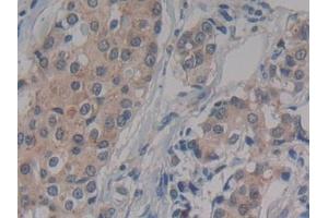 Immunohistochemistry (IHC) image for anti-Interferon alpha/beta Receptor 2 (IFNAR2) (AA 27-243) antibody (ABIN7435736)