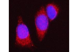IF analysis of Spindly/SPDL1 using anti-Spindly/SPDL1 antibody (ABIN7601654). (CCDC99 antibody  (AA 40-605))