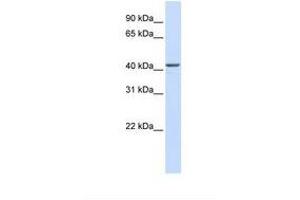 Image no. 1 for anti-RNA-Binding Protein NOB1 (NOB1) (AA 326-375) antibody (ABIN6739030) (NOB1 antibody  (AA 326-375))