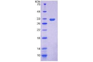 SDS-PAGE (SDS) image for Mitogen-Activated Protein Kinase Kinase Kinase 5 (MAP3K5) (AA 681-936) protein (His tag) (ABIN4988680)