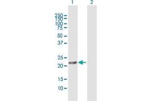 Western Blot analysis of MGC4172 expression in transfected 293T cell line by MGC4172 MaxPab polyclonal antibody. (DHRS11 antibody  (AA 1-181))