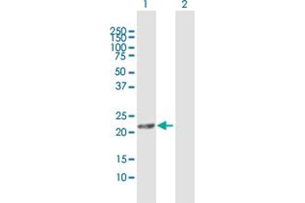 DHRS11 antibody  (AA 1-181)