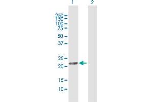 DHRS11 antibody  (AA 1-181)