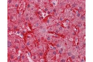 IHC testing of FFPE human liver tissue with Arginase 1 antibody at 3. (Liver Arginase antibody)