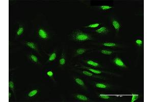Immunofluorescence of purified MaxPab antibody to NEK3 on HeLa cell. (NEK3 antibody  (AA 1-506))