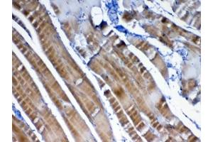IHC testing of FFPE rat skeletal muscle tissue with VEGFB antibody at 1ug/ml. (VEGFB (VEGF2) antibody)