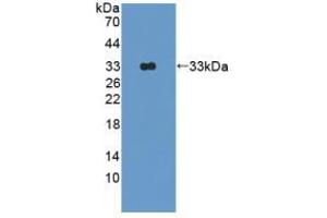 Western blot analysis of recombinant Rat OAS1. (OAS1 antibody  (AA 139-358))