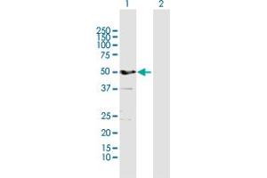 Western Blot analysis of ALDH3A1 expression in transfected 293T cell line by ALDH3A1 MaxPab polyclonal antibody. (ALDH3A1 antibody  (AA 1-453))