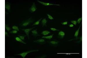 Immunofluorescence (IF) image for anti-ELAV (Embryonic Lethal, Abnormal Vision, Drosophila)-Like 1 (Hu Antigen R) (ELAVL1) (AA 1-326) antibody (ABIN947826)