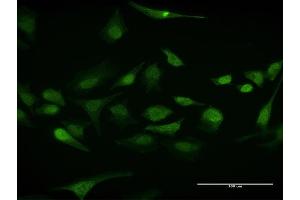 Immunofluorescence of purified MaxPab antibody to ELAVL1 on HeLa cell.