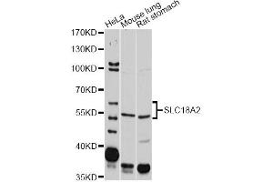 Western blot analysis of extracts of various cell lines, using SLC18A2 antibody (ABIN1874806) at 1:2000 dilution. (SLC18A2 antibody)