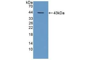 Detection of Recombinant TPP1, Mouse using Polyclonal Antibody to Tripeptidyl Peptidase I (TPP1)