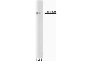 Western blot analysis of Stat6 on jurkat lysate. (STAT6 antibody  (C-Term))