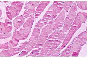 Anti-XPR1 antibody IHC staining of human skeletal muscle. (xpr1 antibody  (N-Term))