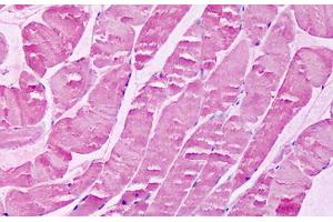 xpr1 antibody  (N-Term)