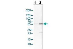Western blot analysis of Lane 1: NIH/3T3 cell lysate and Lane 2: NBT-II cell lysate with LYN polyclonal antibody . (LYN antibody  (AA 7-147))