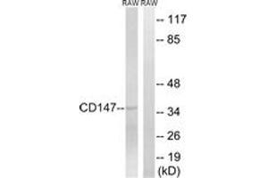 Western blot analysis of extracts from RAW264. (CD147 antibody  (AA 336-385))