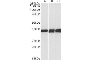 ABIN4902695 (0. (LDHB antibody)