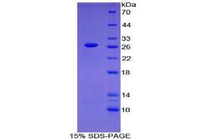SDS-PAGE analysis of Human Nephronectin Protein.
