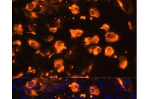 Immunofluorescence analysis of C6 cells using JAG2 Polyclonal Antibody at dilution of 1:100. (JAG2 antibody)