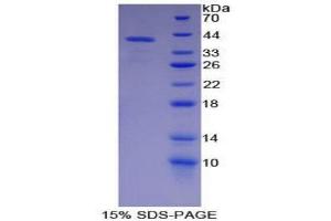 SDS-PAGE (SDS) image for Parathyroid Hormone (PTH) (AA 32-115) protein (His tag,GST tag) (ABIN2123446)
