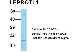 Host: Rabbit Target Name: LEPROTL1 Sample Type: Human HepG2 Antibody Dilution: 1. (LEPROTL1 antibody  (N-Term))