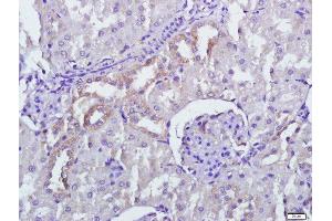 Paraformaldehyde-fixed, paraffin embedded rat kidney tissue, Antigen retrieval by boiling in sodium citrate buffer(pH6) for 15min, Block endogenous peroxidase by 3% hydrogen peroxide for 30 minutes, Blocking buffer (normal goat serum) at 37°C for 20min, Antibody incubation with Rabbit Anti-PERK Polyclonal Antibody, Unconjugated  at 1:500 overnight at 4°C, followed by a conjugated secondary and DAB staining (PERK antibody  (AA 1001-1116))
