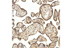 IHC analysis of Citrin/SLC25A13 using anti-Citrin/SLC25A13 antibody (ABIN7599512). (slc25a13 antibody  (AA 1-643))