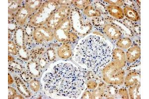 ABIN184613 (4µg/ml) staining of paraffin embedded Human Kidney. (WRNIP1 antibody  (C-Term))