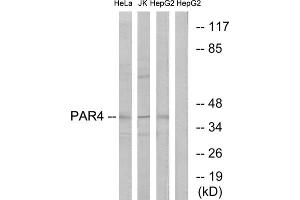 Western blot analysis of extracts from HeLa cells, Jurkat cells and HepG2 cells, using PAR4 antibody. (F2RL3 antibody  (Internal Region))