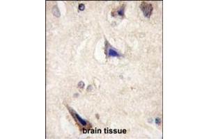 Formalin-fixed and paraffin-embedded human brain tissue reacted with LGR5/GPR49 antibody (loop1) (ABIN389217 and ABIN2839372) , which was peroxidase-conjugated to the secondary antibody, followed by DAB staining. (LGR5 antibody  (AA 605-638))